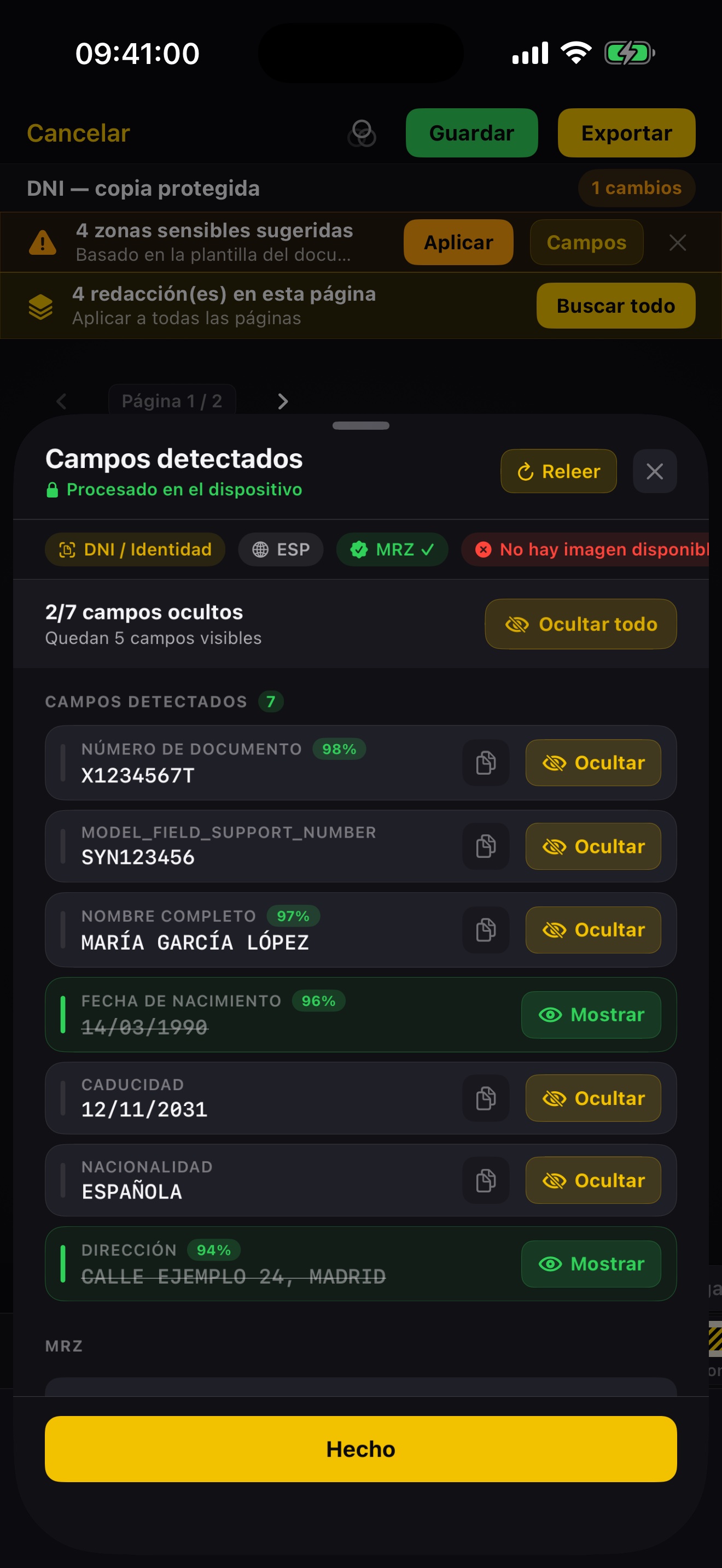 Shield - Sugerencias OCR revisables